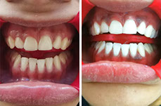 Tenemos refacciones de diferentes modelos y años, así como accesorios. 